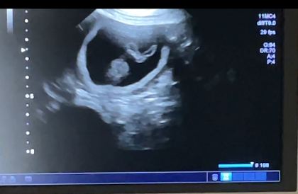 Joy ultrasound 4